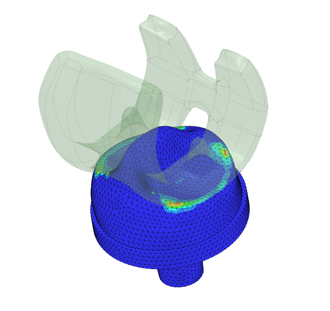knee implant FEA case image